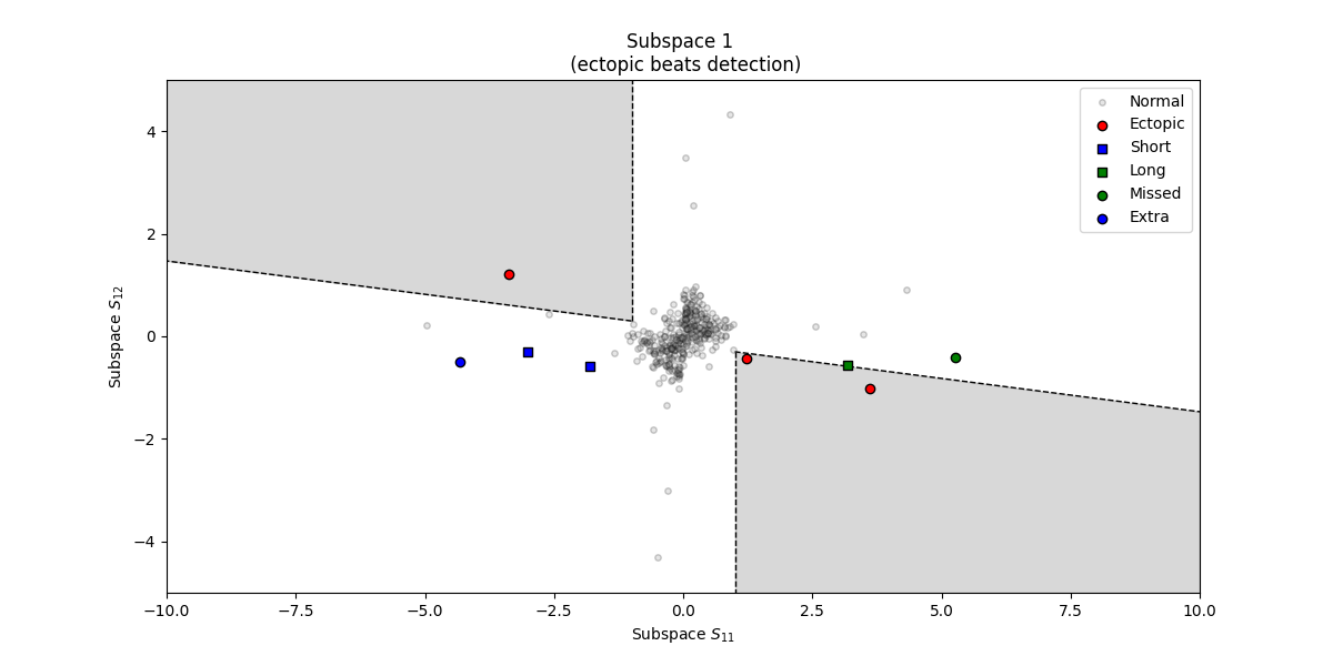 Subspace 1   (ectopic beats detection)