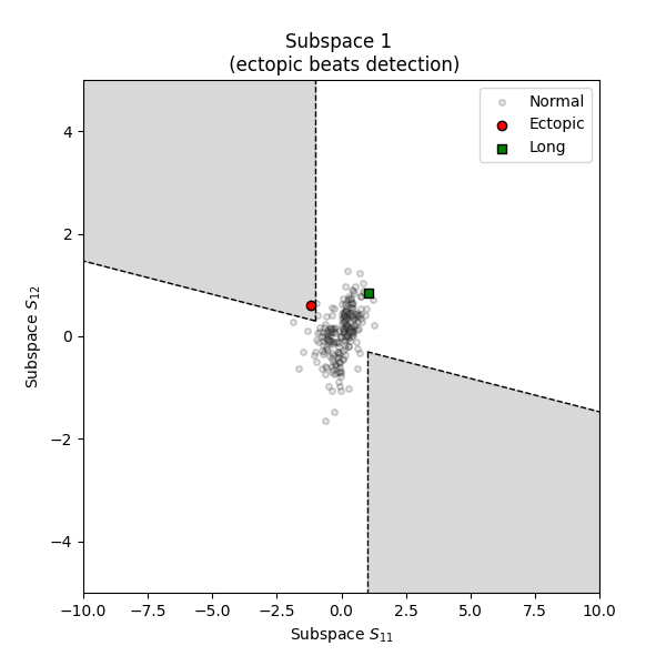 Subspace 1   (ectopic beats detection)