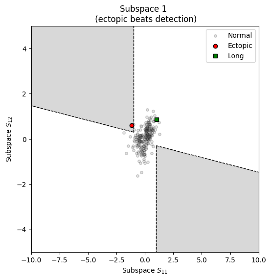 ../../_images/systole.plots.plot_ectopic_0_1.png