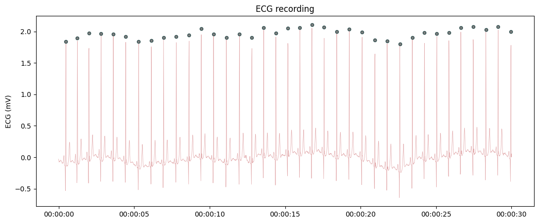 ../../_images/systole.plots.plot_raw_0_5.png
