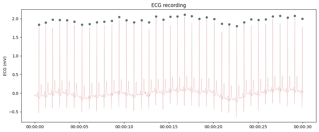 ../../_images/systole.plots.plot_raw_0_6.png