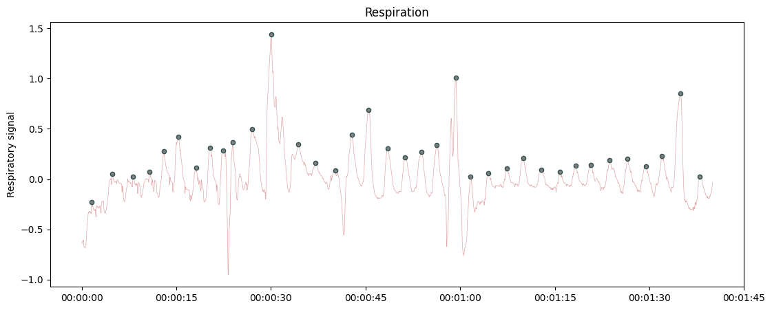 ../../_images/systole.plots.plot_raw_1_5.png