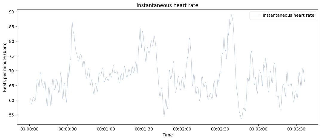 ../../_images/systole.plots.plot_rr_1_0.png